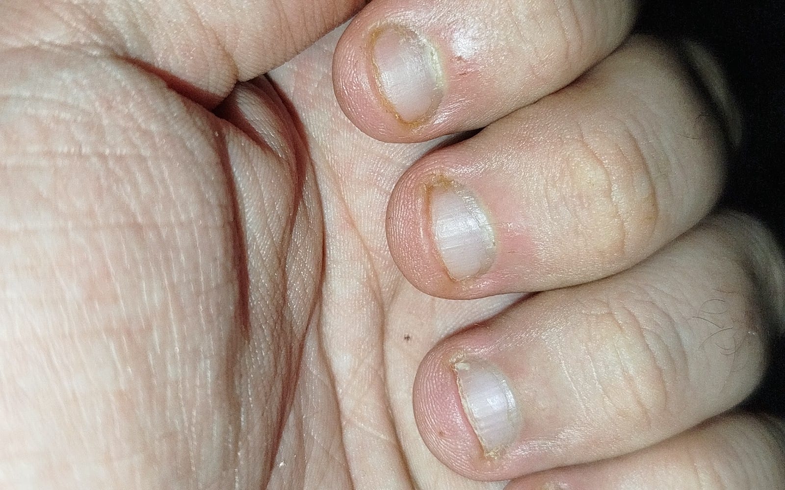 Small nails